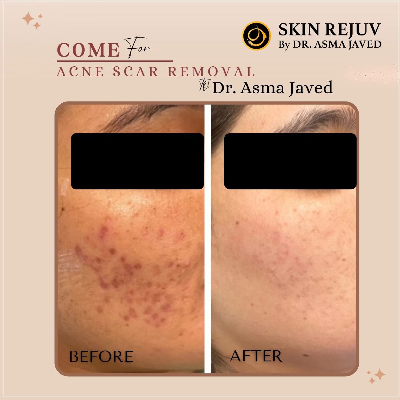 Before After Treatment 5